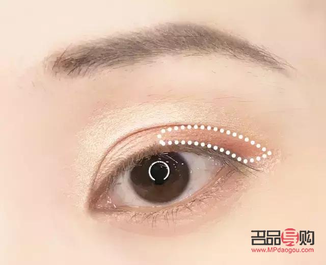 天生上眼皮肿怎么消除(天生上眼皮肿怎么消除常见方法) 天生上眼皮肿怎么消除(天生上眼皮肿怎么消除常见方法)