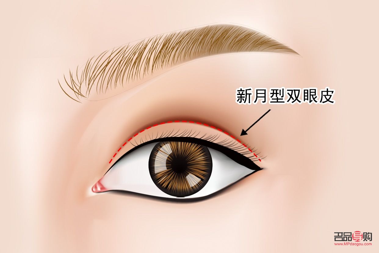 新月型双眼皮为什么会显老(新月型双眼皮为什么会显老一点)