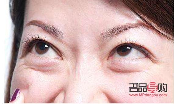 轻微眼袋怎么去除最快(轻微眼袋怎么去除最快方法)