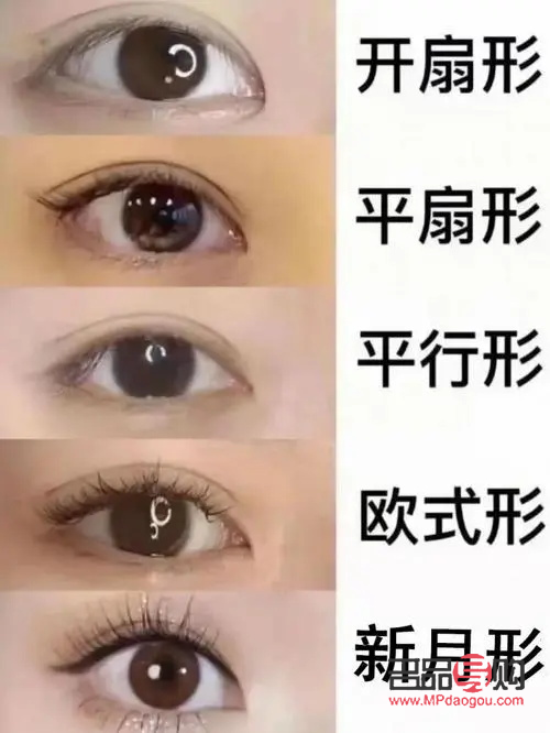 <h3>平扇型双眼皮恢复图详解</h3>