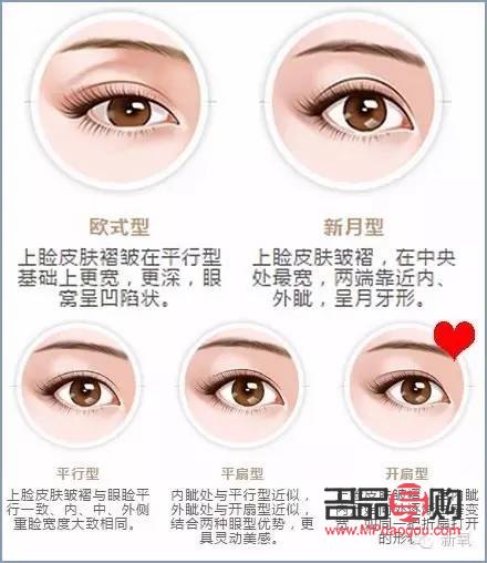 上眼皮突然有褶皱图片(上眼皮多层褶皱怎么办)