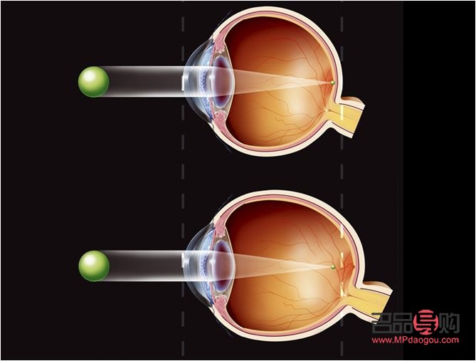 怎么才能保养眼睛(怎么才能保养眼睛不近视) 怎么才能保养眼睛(怎么才能保养眼睛不近视)