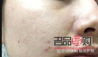 <h3>身体乳与手部护理：一种多功能的护肤选择</h3>