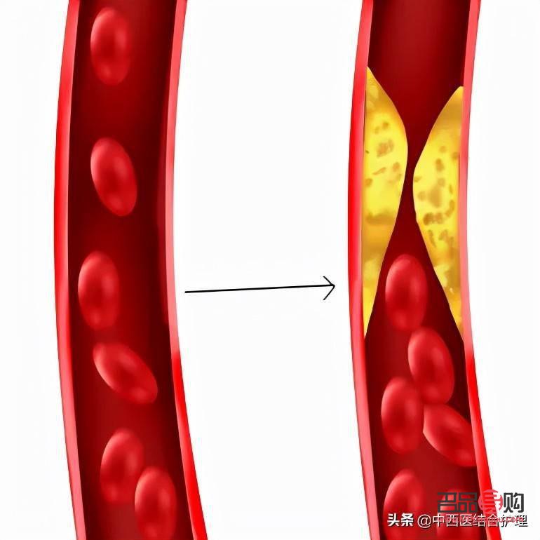 <h3>身体乳与手部护理：一种多功能的护肤选择</h3>