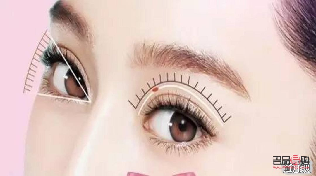 双眼皮三点定位是什么意思(双眼皮三点定位好吗)