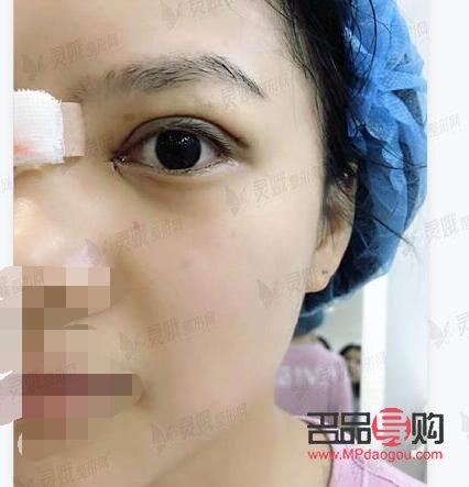 <h3>宜昌双眼皮整形，哪家医院更出众？</h3>