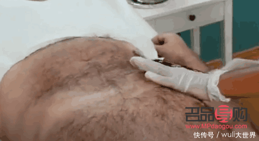 怎么脱毛美容(怎么脱毛美容效果好)