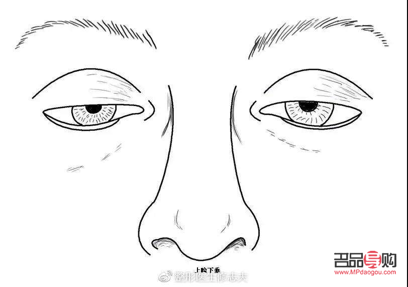 <h3>眼睛肌无力：探寻治愈之路</h3>