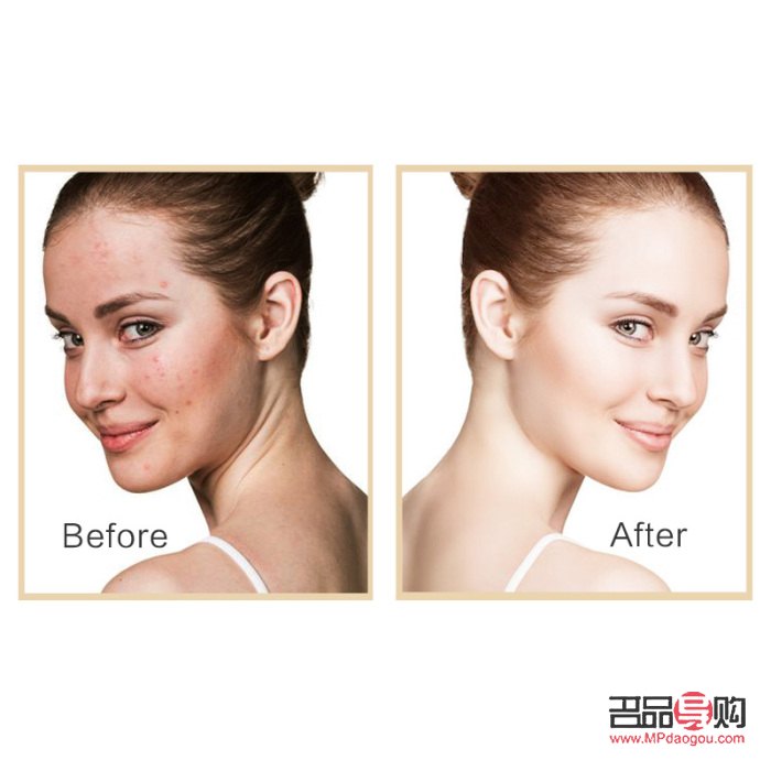 美容不足的坏处及影响