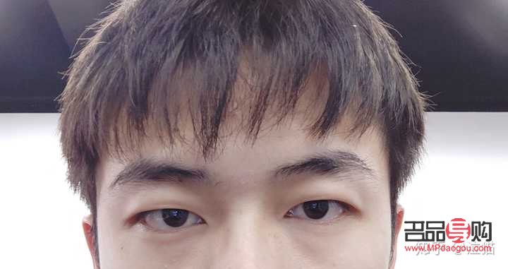 <h3>眼睛高低不对称怎么办？专业解答与实用建议</h3>