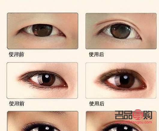 双眼皮的魅力：哪些人更适合拥有双眼皮？