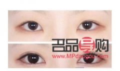 开眼角多少钱大概(开眼角多少钱?) 开眼角多少钱大概(开眼角多少钱?)