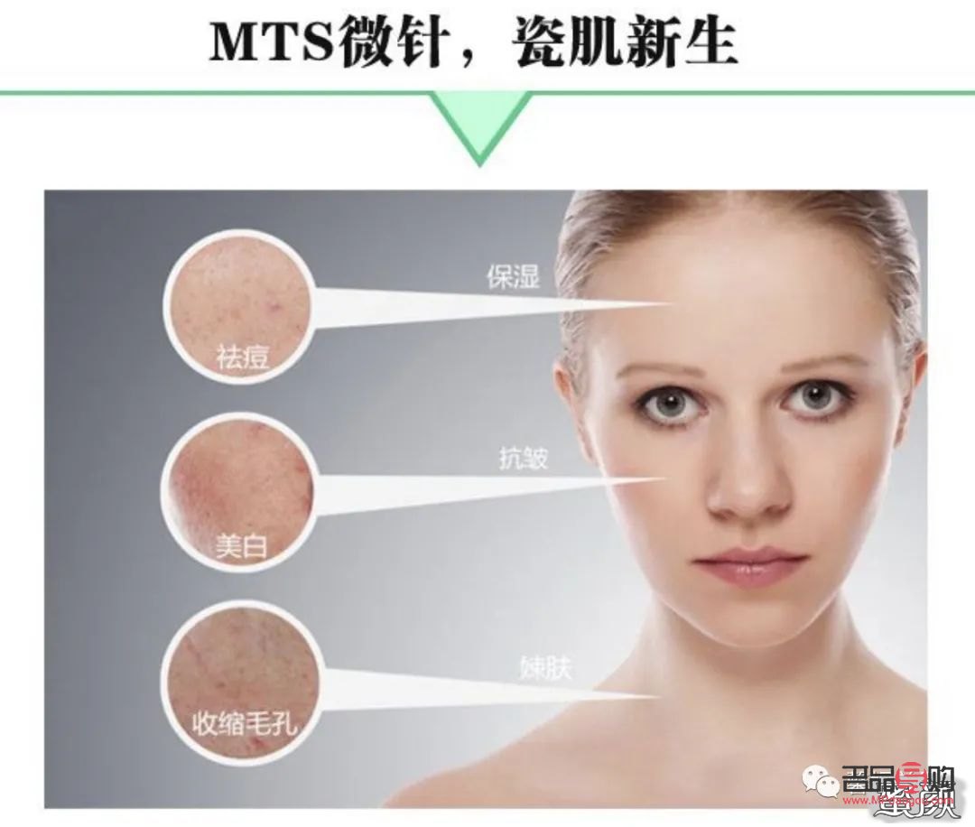 <h3>微针美容：肌肤焕新的秘密武器</h3>