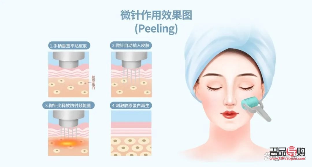 <h3>微针美容：肌肤焕新的秘密武器</h3>