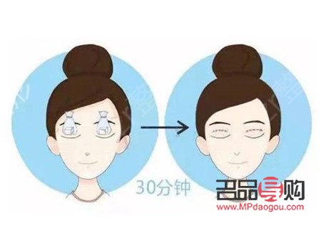 <h3>肿眼泡按摩能否有效消除?</h3> <h3>肿眼泡按摩能否有效消除?</h3>