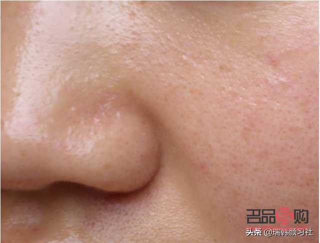 身体皮肤油性怎么护理(身体皮肤油性怎么护理最好)