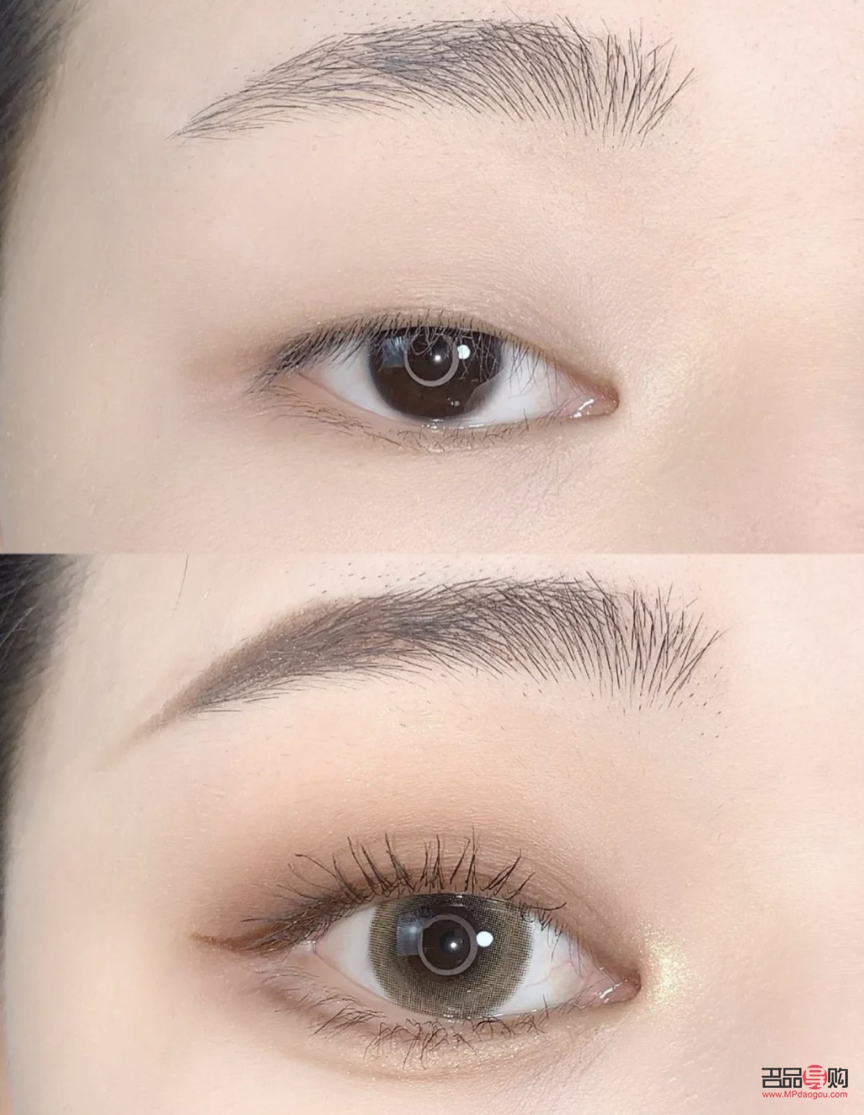 肿眼泡除了手术还有什么办法(肿眼泡除了手术还有什么办法消肿)