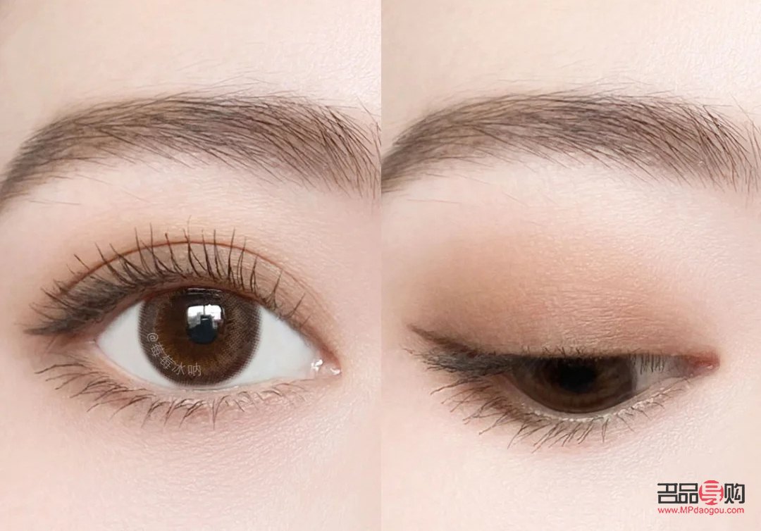 肿眼泡除了手术还有什么办法(肿眼泡除了手术还有什么办法消肿)