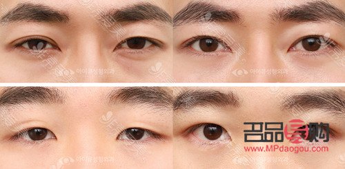 双眼皮眼型图片男(双眼皮眼型图片男人) 双眼皮眼型图片男(双眼皮眼型图片男人)