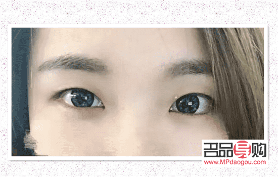 割双眼皮加开眼角要多少钱(割双眼皮加开眼角要多少钱一次) 割双眼皮加开眼角要多少钱(割双眼皮加开眼角要多少钱一次)