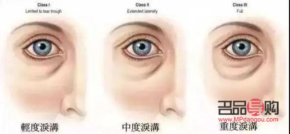 <h3>眼部抗衰效果深度解析</h3>