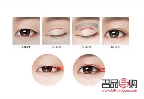 <h3>自己动手,打造双眼皮魅力</h3> <h3>自己动手,打造双眼皮魅力</h3>