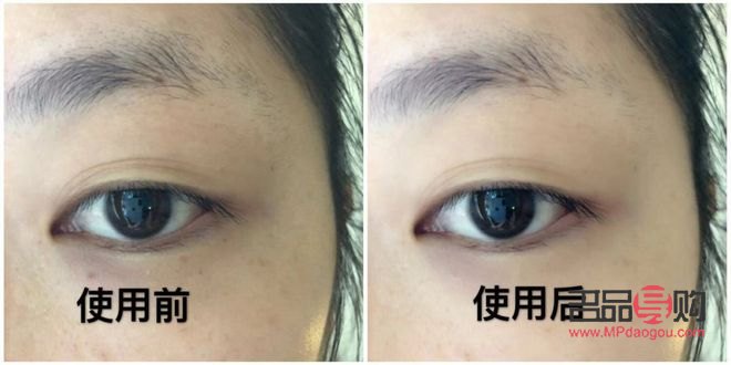 黑眼圈与眼袋的终结者：快速消除秘籍大公开