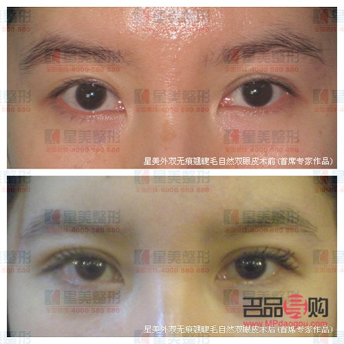 美容医保报销吗(整形美容科医保报销吗)