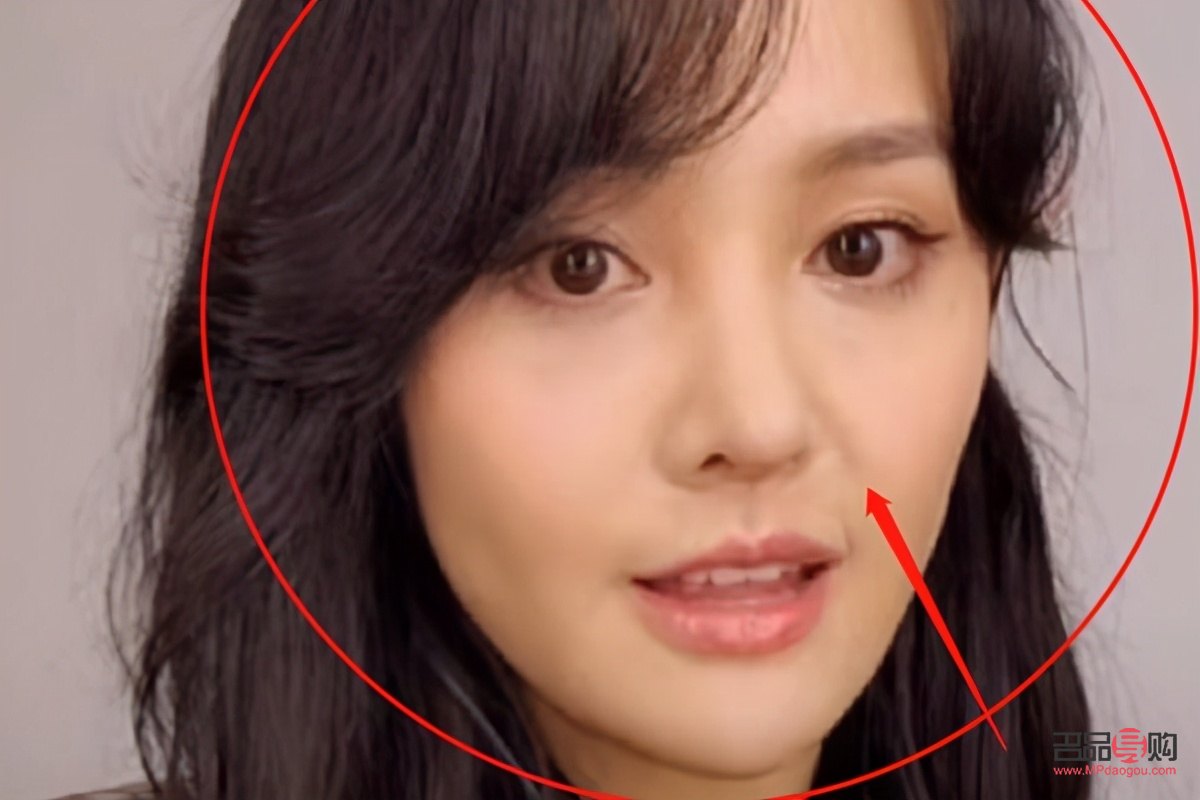 填充眼窝凹陷手术多少钱啊图片(填充眼窝凹陷手术多少钱啊图片视频) 填充眼窝凹陷手术多少钱啊图片(填充眼窝凹陷手术多少钱啊图片视频)