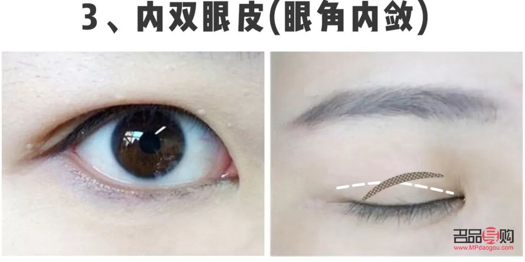 什么样的双眼皮才好看(什么样的双眼皮才好看图片) 什么样的双眼皮才好看(什么样的双眼皮才好看图片)