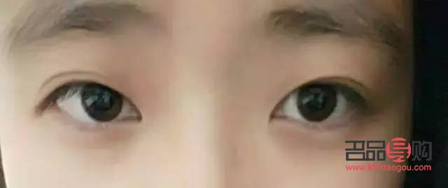 什么样的双眼皮才好看(什么样的双眼皮才好看图片) 什么样的双眼皮才好看(什么样的双眼皮才好看图片)