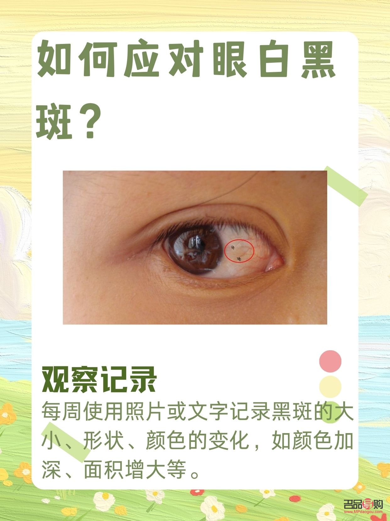 眼睛白色部分有黑色斑块(儿童眼睛白色部分有黑色斑块)