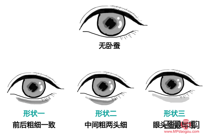 何为卧蚕眼(什么叫卧蚕眼睛)