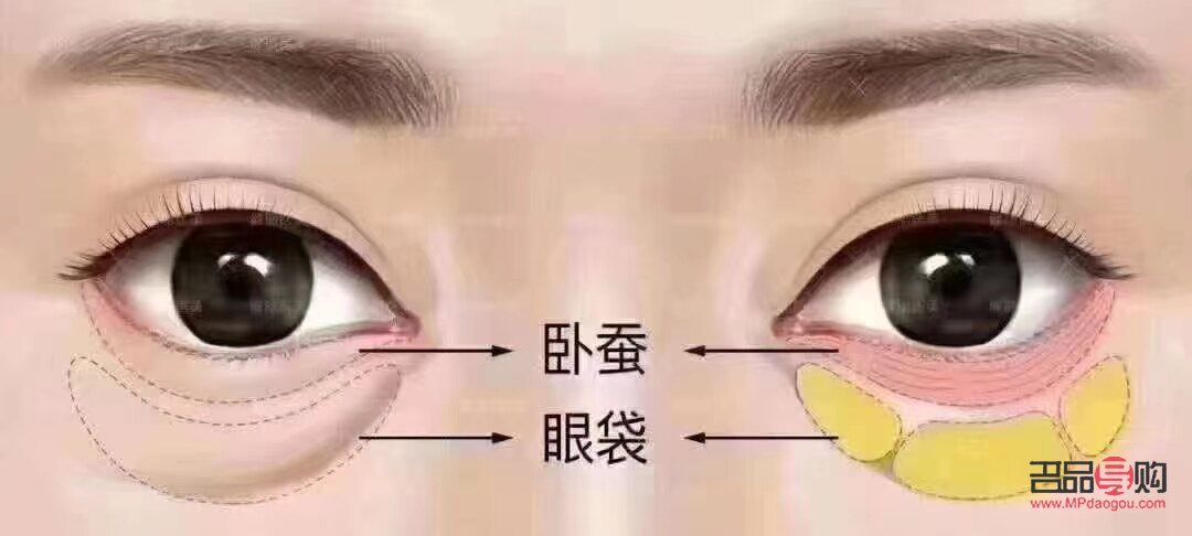 何为卧蚕眼(什么叫卧蚕眼睛)