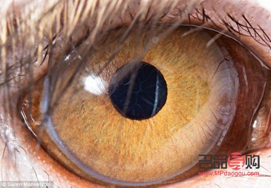 眼睛增生处理方法大揭秘