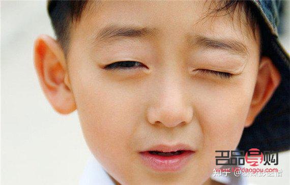 小孩眼睛老是斜瞟(孩子眼睛时不时斜瞟一下) 小孩眼睛老是斜瞟(孩子眼睛时不时斜瞟一下)