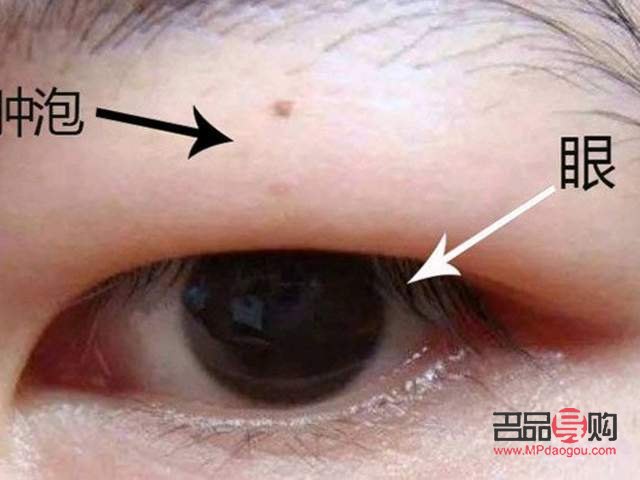 双眼皮肿眼泡怎么画眼妆(双眼皮肿眼泡怎么画眼妆图片)
