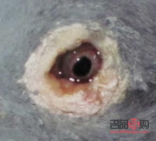 <h3>单眼肿胀原因解析</h3> <h3>单眼肿胀原因解析</h3>