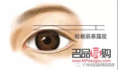 <h3>上眼皮松弛是否可以割双眼皮？</h3>