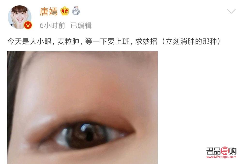 小眼综合一般需要多少钱(小眼综合一般需要多少钱一次) 小眼综合一般需要多少钱(小眼综合一般需要多少钱一次)