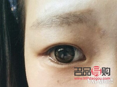 <h3>女人肿眼泡，福气之象征？</h3>