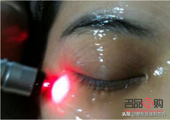 美容祛斑会反弹吗(激光美容祛斑会反弹吗)