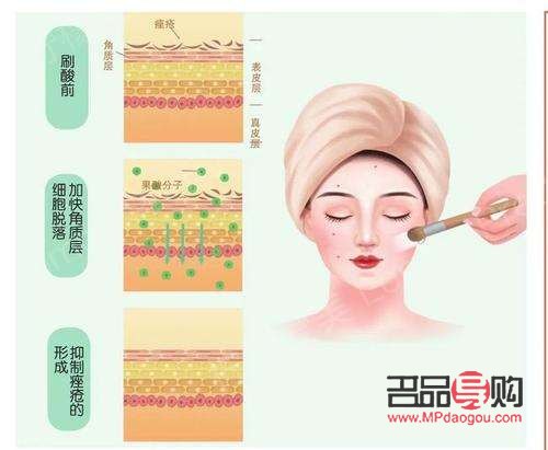 身体刷酸冬天怎么护理(身体刷酸冬天怎么护理皮肤)