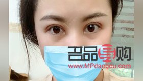 平扇双眼皮洋气吗(平扇双眼皮洋气吗)