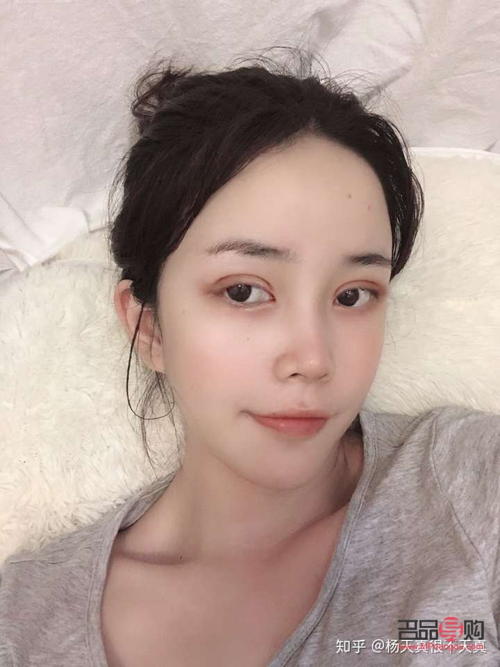 探索双眼皮手术：哪种双眼皮最自然、最好看？