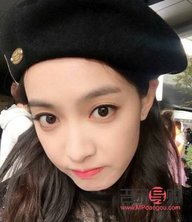 大小眼一只眼睛肌无力(大小眼一只眼睛肌无力怎么治疗)