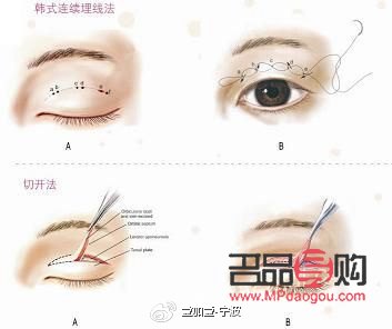 <h3>双眼皮美学:探寻最洋气的双眼皮风格</h3> <h3>双眼皮美学:探寻最洋气的双眼皮风格</h3>