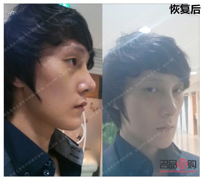 在哪个整形美容好(哪个整形美容医院好)