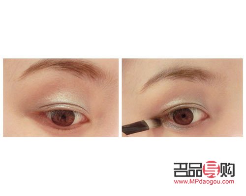 大眼综合真实恢复期图片(大眼综合的恢复过程) 大眼综合真实恢复期图片(大眼综合的恢复过程)