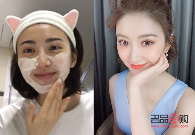 <h3>双眼皮二次手术:需求、风险与考量</h3> <h3>双眼皮二次手术:需求、风险与考量</h3>